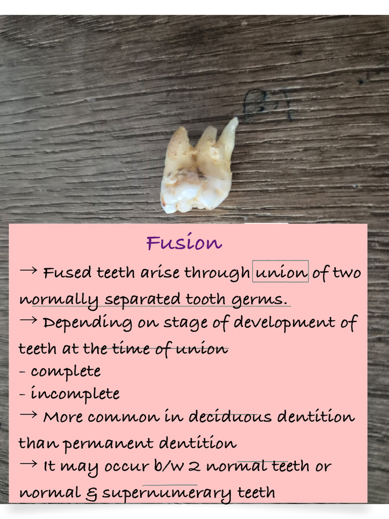 Understanding Dental Anomalies and Conditions | PDF