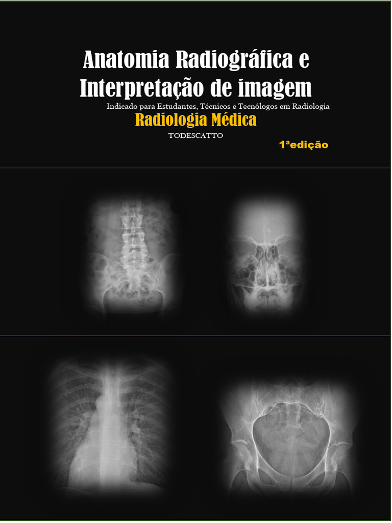Anatomia Radiográfica para Radiologia | PDF | Imagiologia médica ...