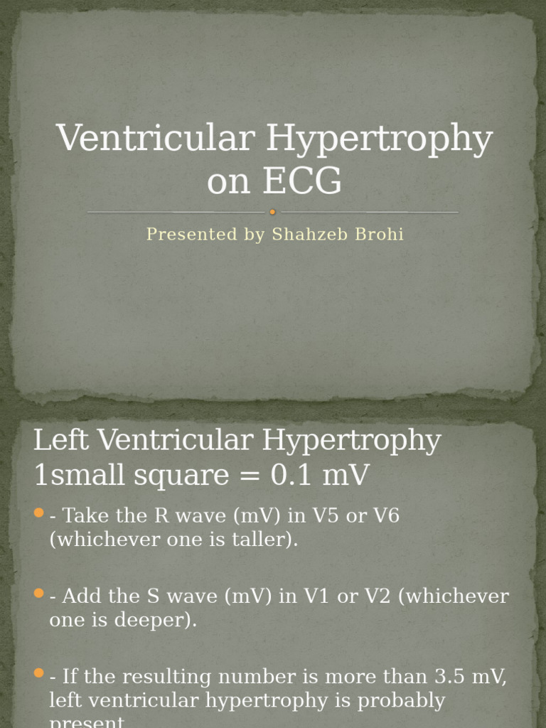 ECG Criteria for Ventricular Hypertrophy | PDF | Cardiology ...