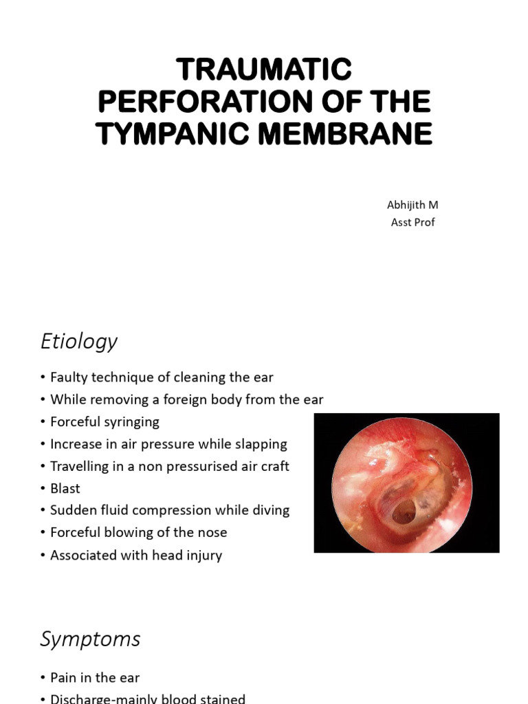 Traumatic Perforation of The Tympanic Membrane | PDF | Ear | Diseases ...