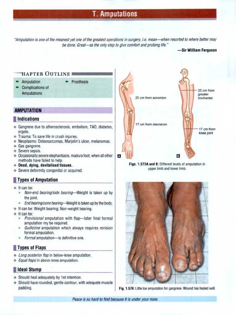 Amputation Techniques and Management | PDF | Amputation | Prosthesis