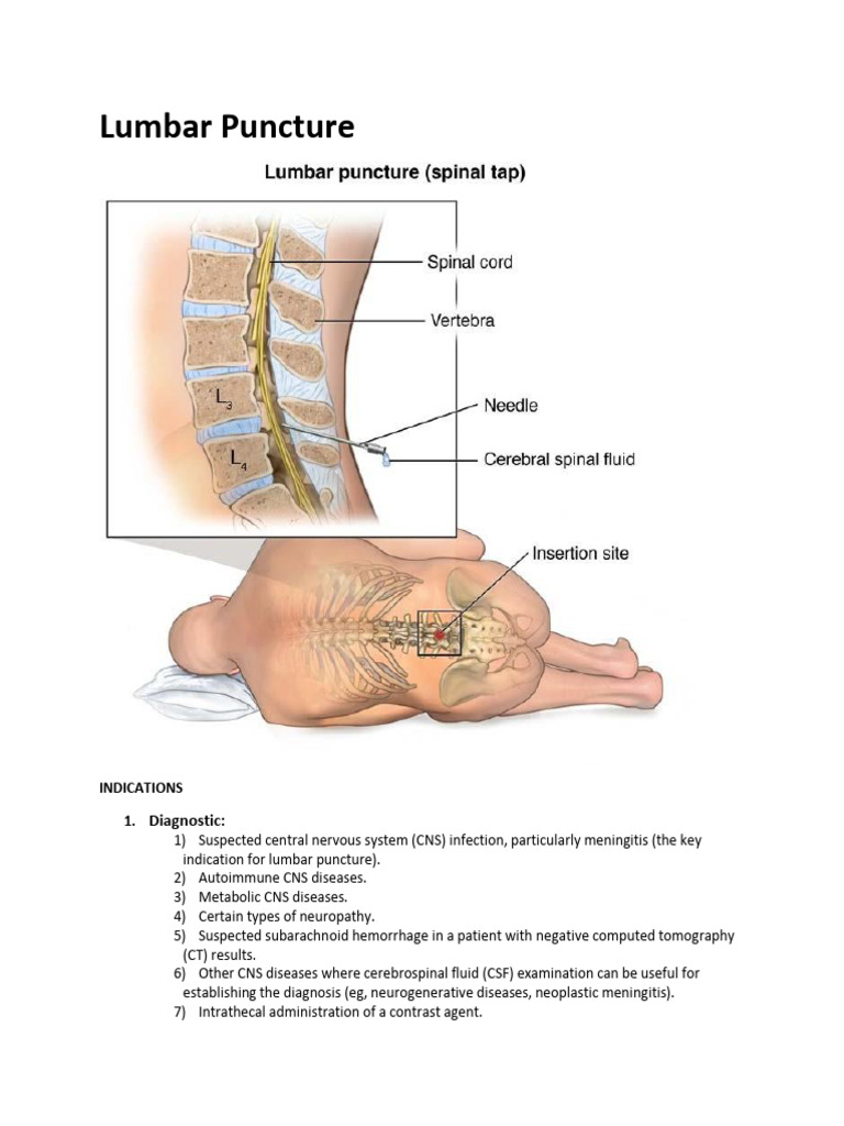 Lumbar Puncture: Diagnostic | PDF | Meningitis | Cerebrospinal Fluid