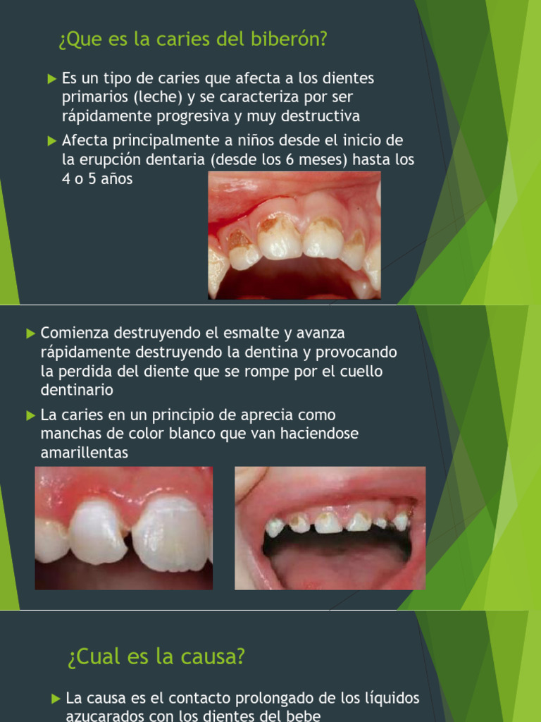 Caries Del Biberón o Rampante Borrador | PDF