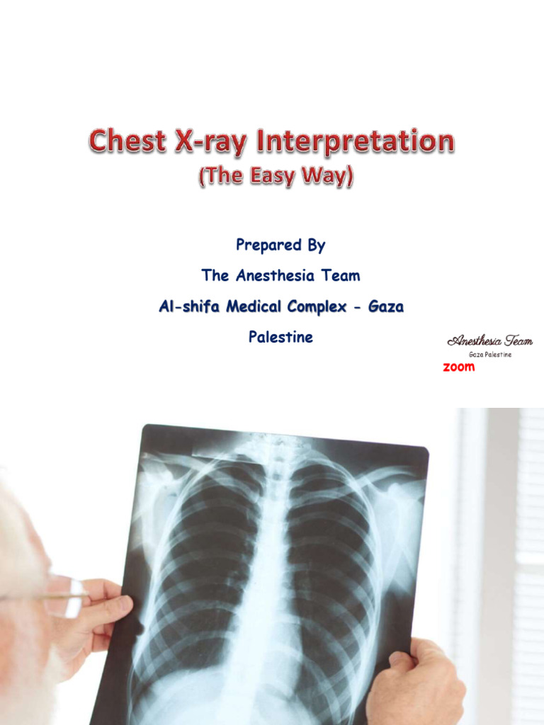 Chest X-Ray Interpretation Guide | PDF