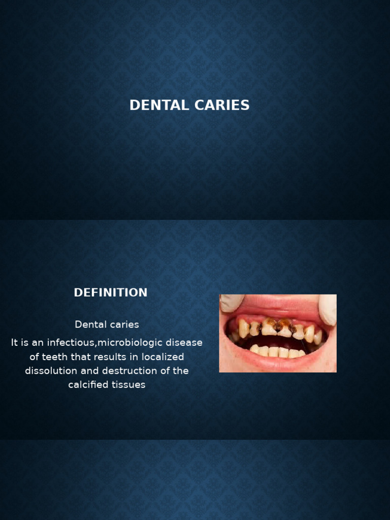 Dental Caries | PDF | Tooth Enamel | Human Tooth