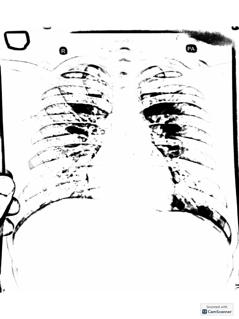 Medical Chest Ex Ray | PDF
