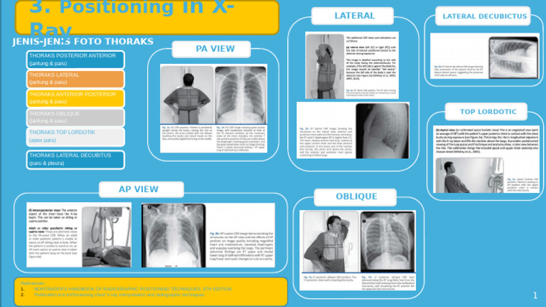 Chest X-Ray Positioning Techniques | PDF