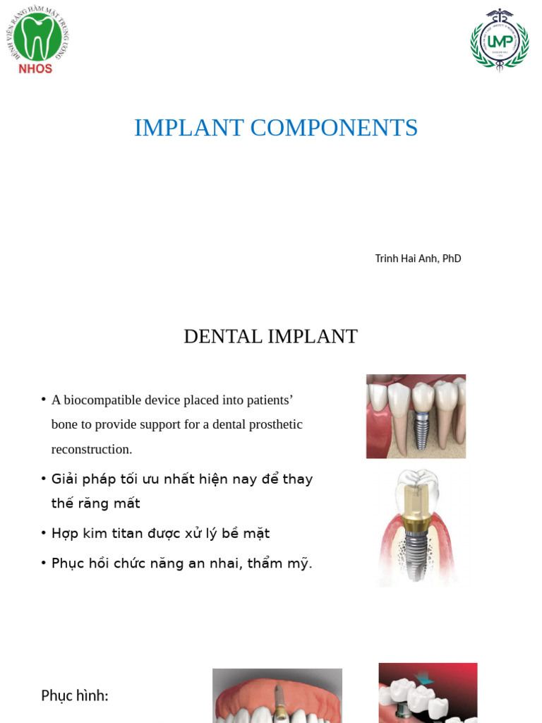 Dental Implant Components Overview | PDF | Dental Implant | Dentistry ...