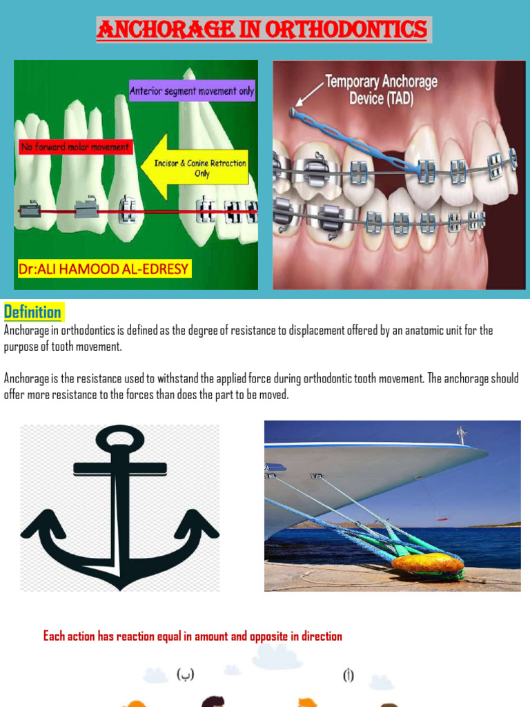 Anchorage Techniques in Orthodontics | PDF | Dental Implant | Dentistry ...