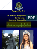 35ekg 1