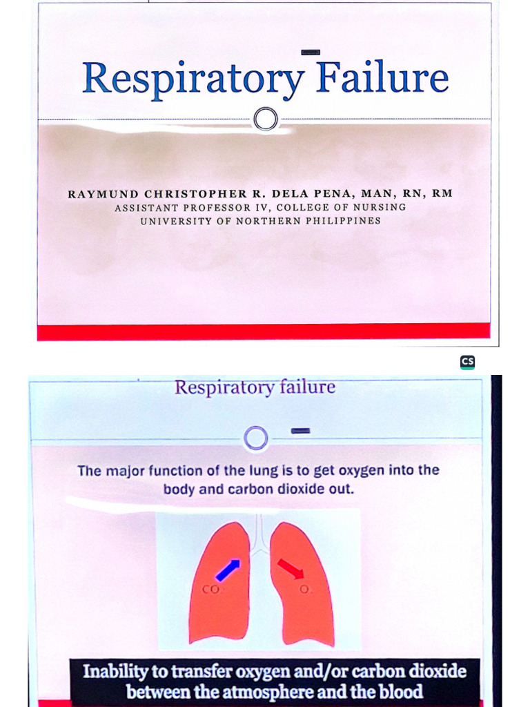 RESP. Failure | PDF