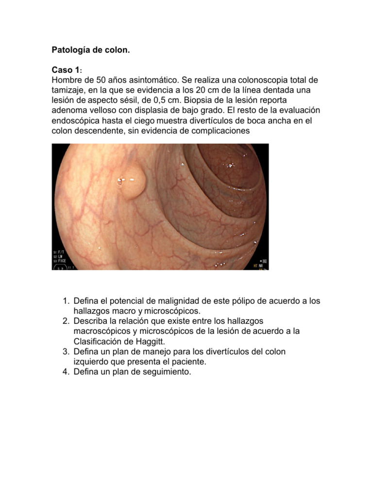 Clasificación de Haggitt en Pólipos de Colon | PDF | Cáncer colonrectal ...