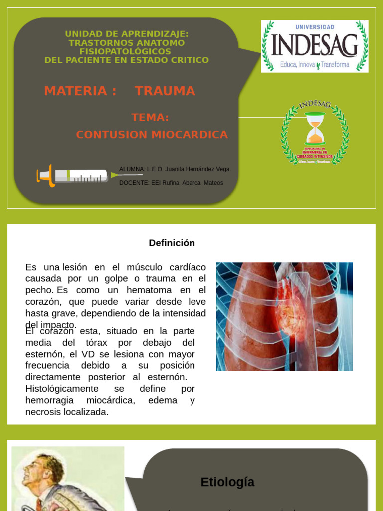Tema Contusion Miocardica 2 | PDF | Infarto de miocardio | Corazón
