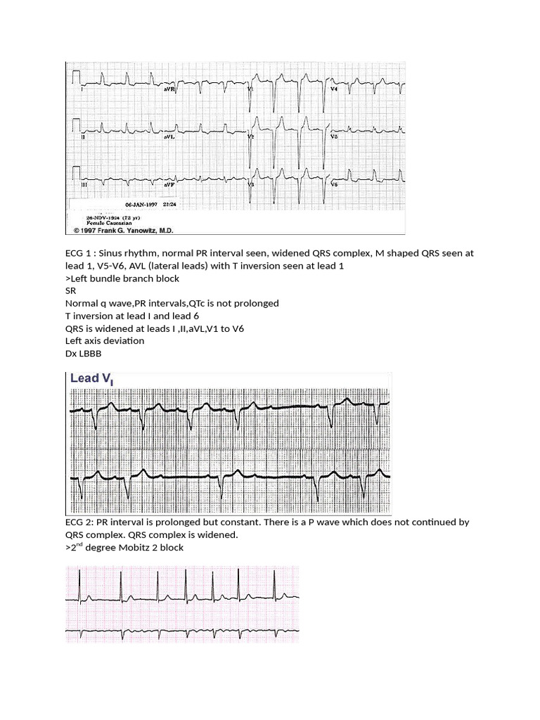 ECG Assignment Edited | PDF