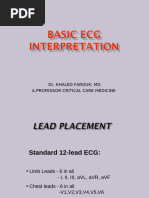 T Wave Abnormalities in ECG Analysis | PDF | Electrocardiography ...