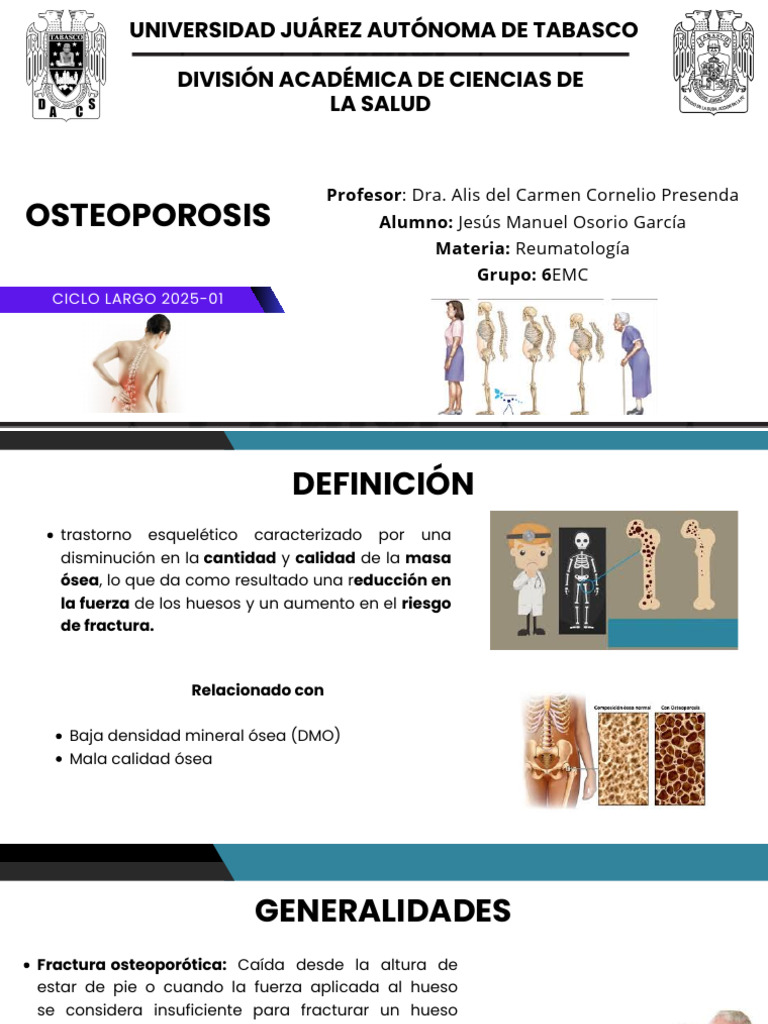 Guía Completa sobre Osteoporosis | PDF | Osteoporosis | Hueso