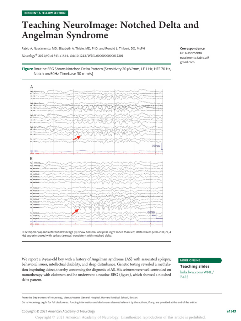 Nascimento Et Al 2021 Teaching Neuroimage Notched Delta and Angelman ...