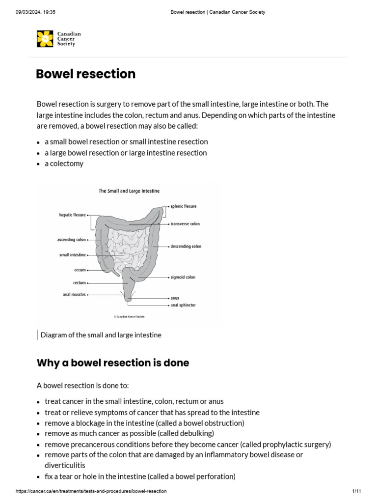 Bowel Resection Surgery Overview | PDF | Gastrointestinal Tract | Large ...