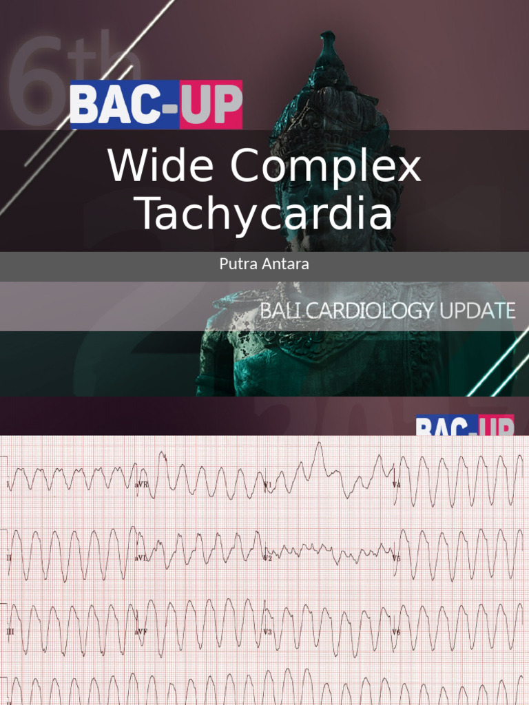 WS ECG - Wide Complex Tachycardia | PDF | Cardiovascular Diseases ...