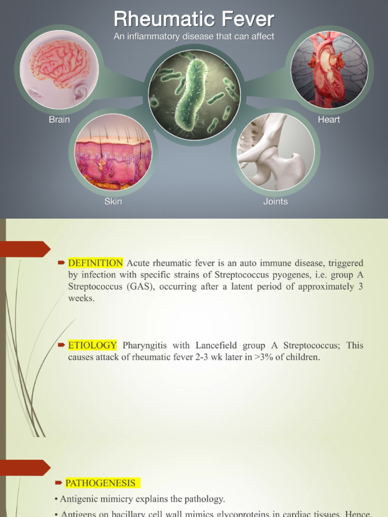 Acute Rheumatic Fever | PDF