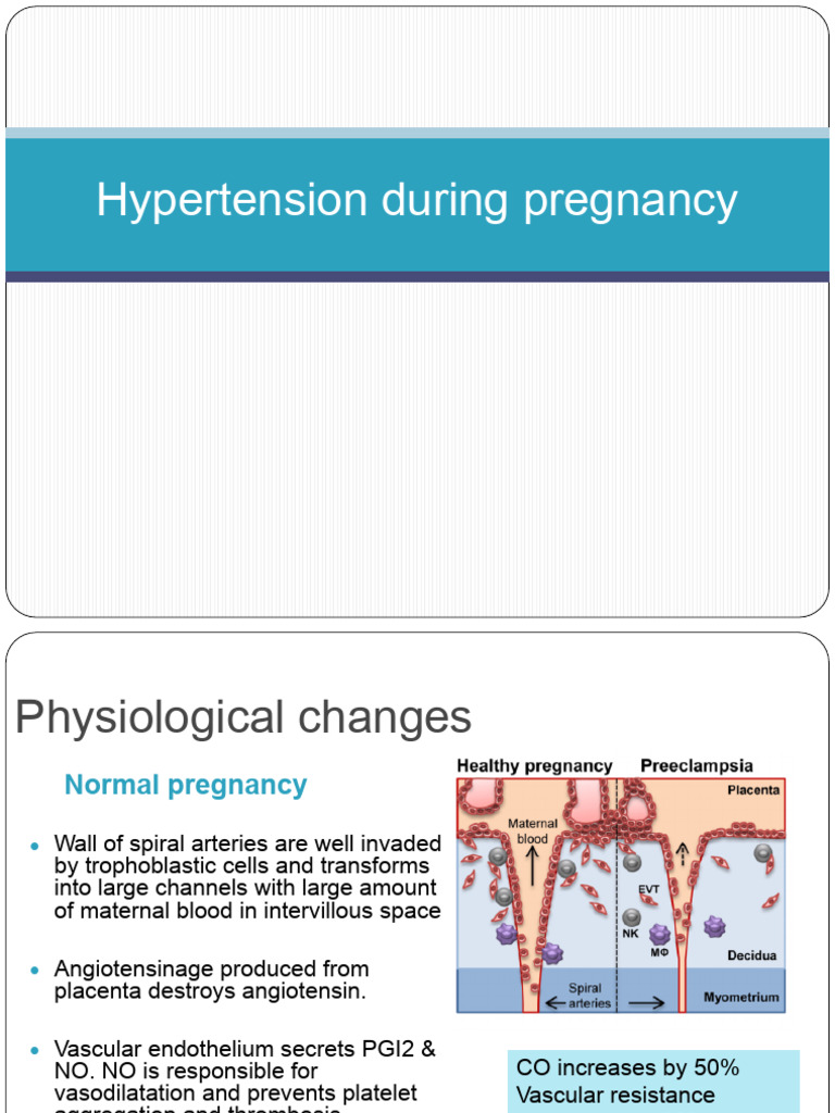 Understanding Hypertension in Pregnancy | PDF | Hypertension | Blood ...