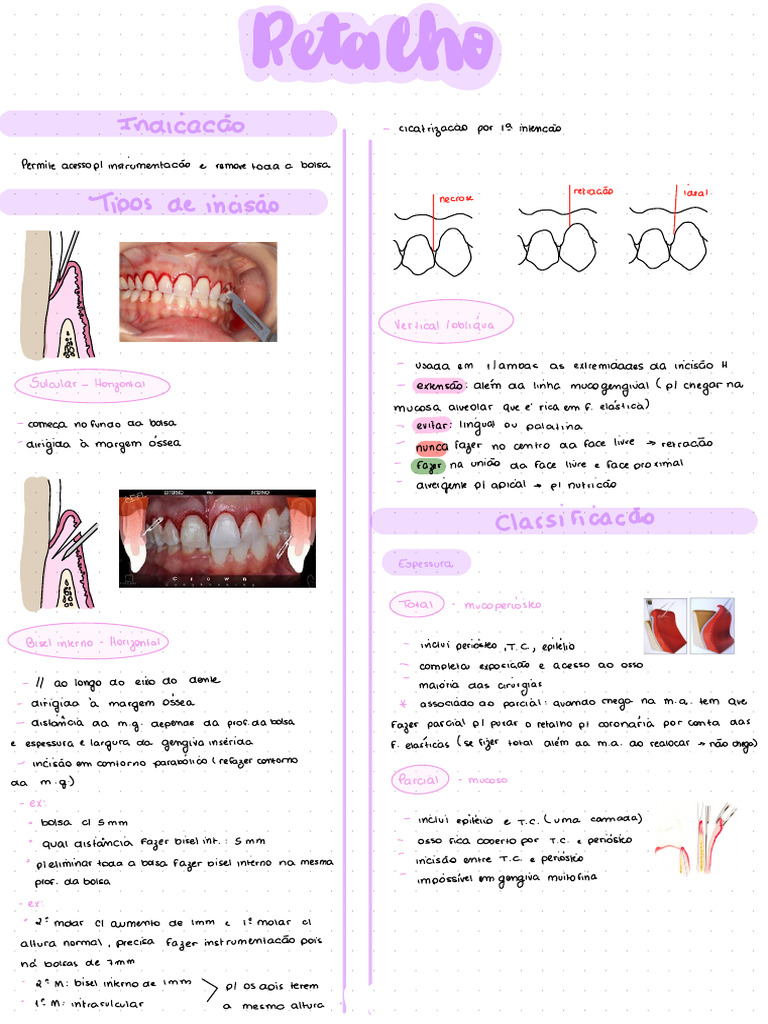 Técnicas de Retalho em Cirurgia Periodontal | PDF