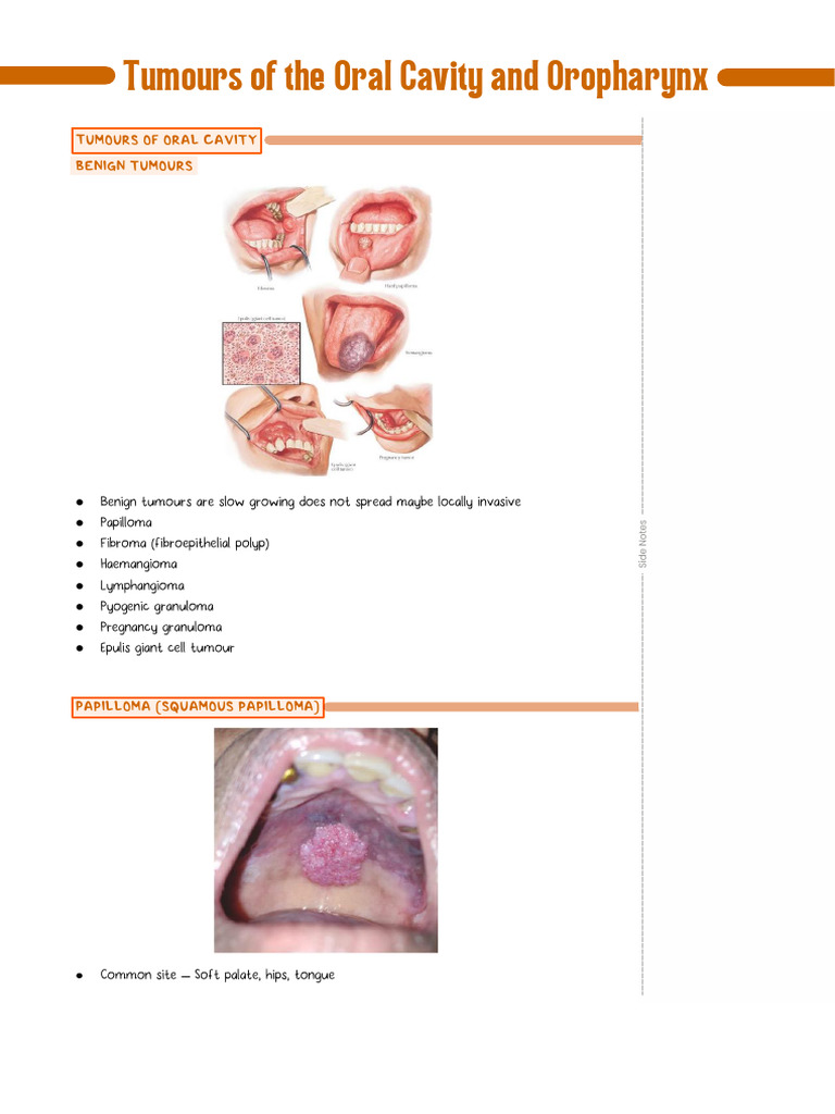Tumours of The Oral Cavity and Oropharynx6773c5421 250122 113645 | PDF ...