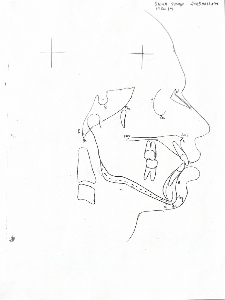 Superimposition | PDF