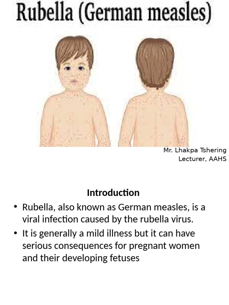 Rubella | PDF | Measles | Public Health
