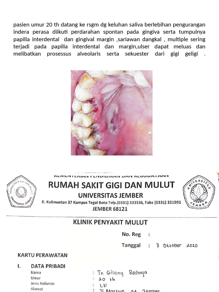 ANUG Ulfa DRG Herna | PDF