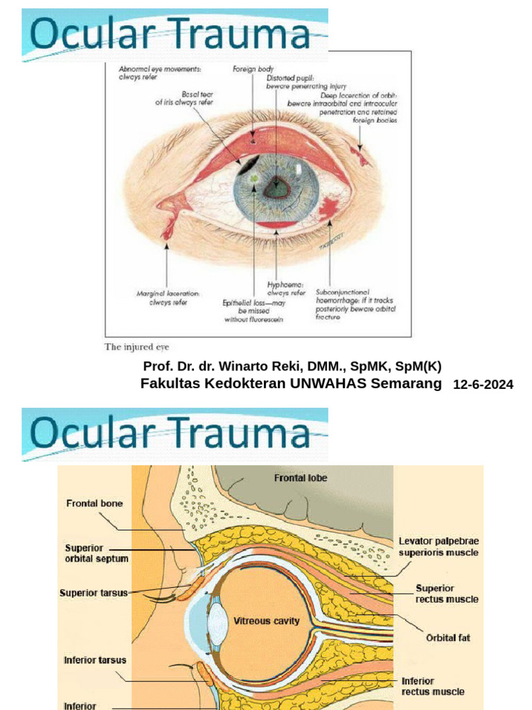 Ocular Trauma: Types, Diagnosis, and Treatment | PDF | Cornea | Burn