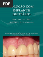 Aula Proviso Rio Sobre Implantes
