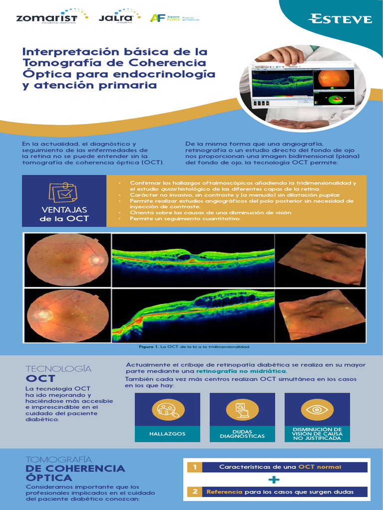 Interpretación de OCT en diabetes | PDF | Retina | Percepción visual