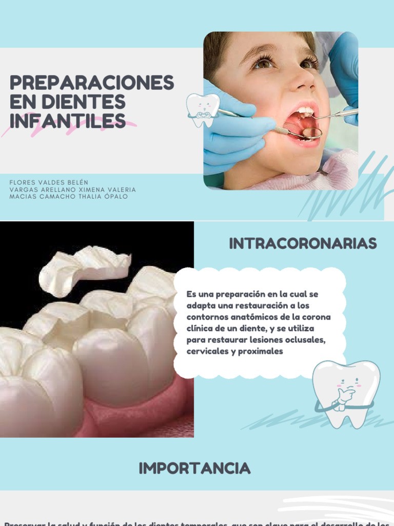 Preparación de Coronas de Acero Cromo | PDF | Materiales | Diente