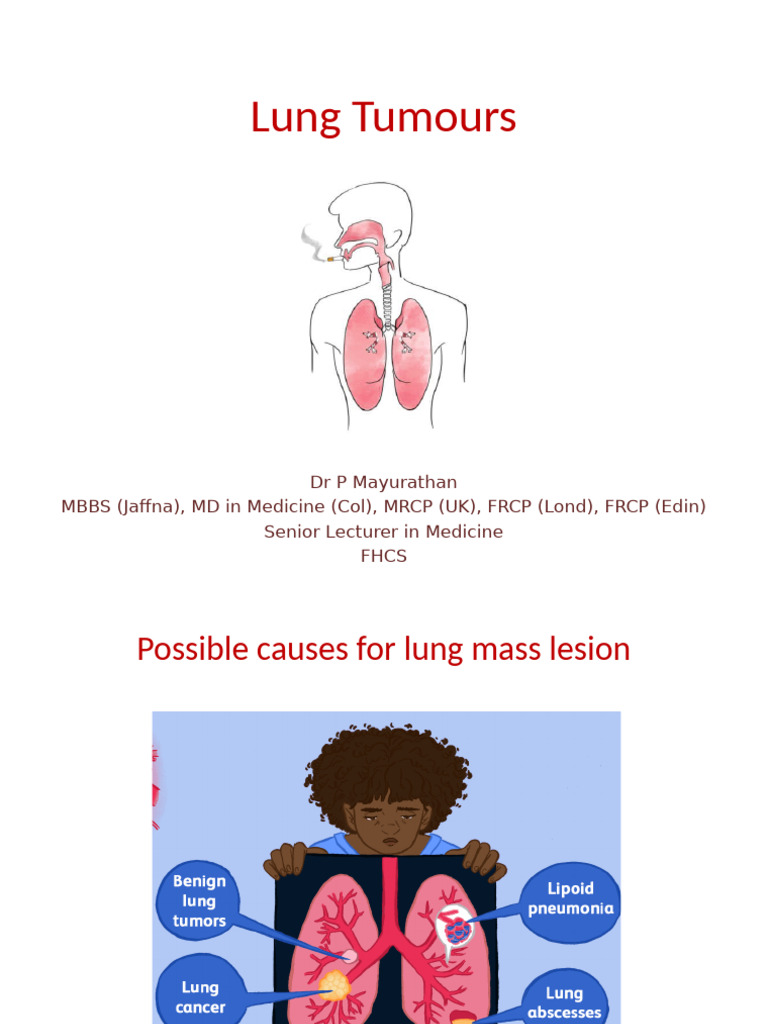 Overview of Lung Tumours and Types | PDF | Lung Cancer | Carcinoma