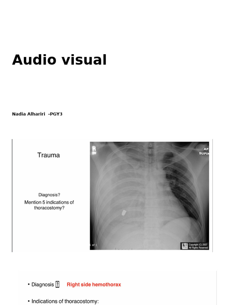 AV Nadia 2 | PDF