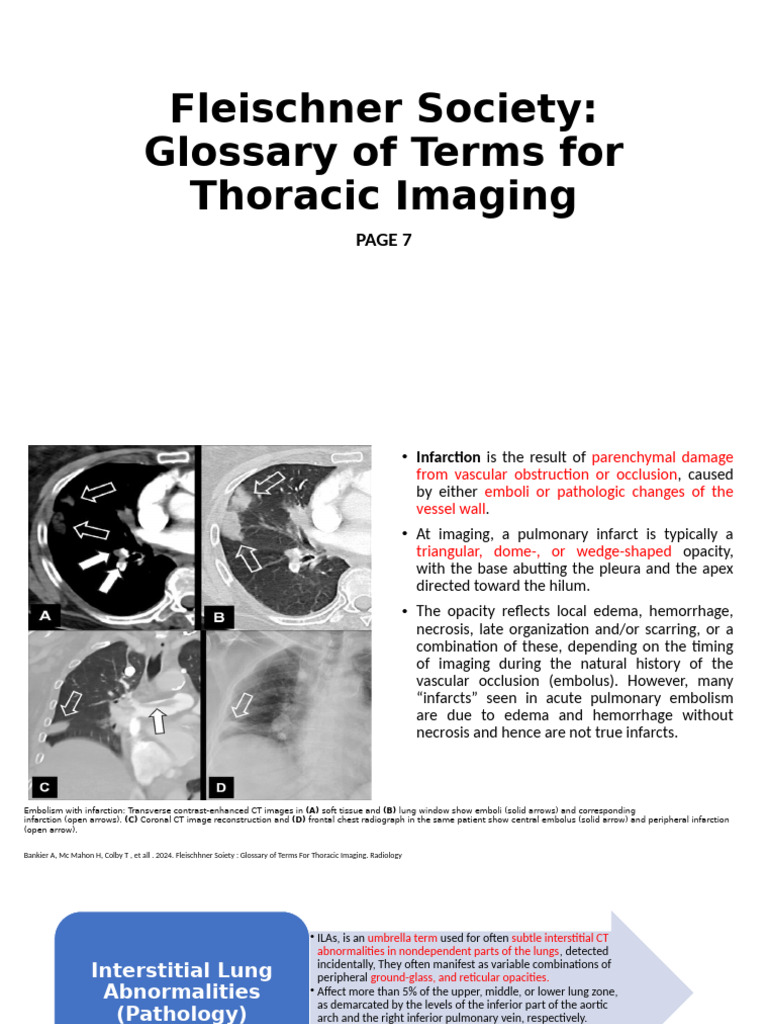 Fleischner Society Thoracic Imaging Terms | PDF | Lung | Embolism
