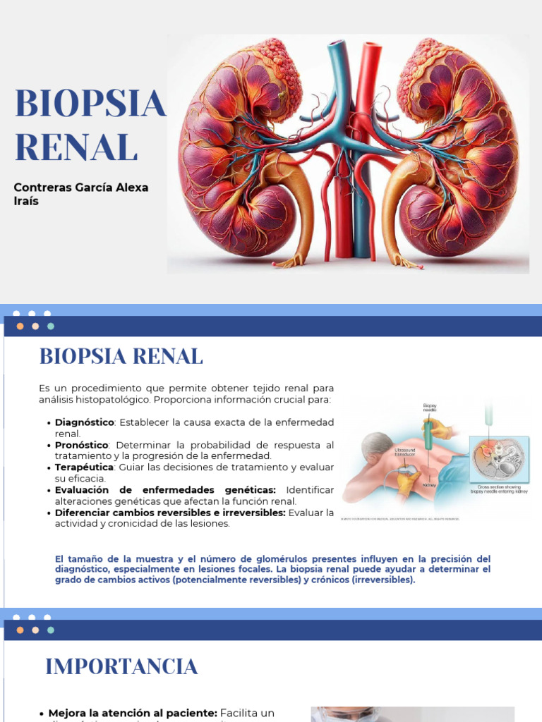 Biopsia Renal: Procedimiento y Complicaciones | PDF | Biopsia ...