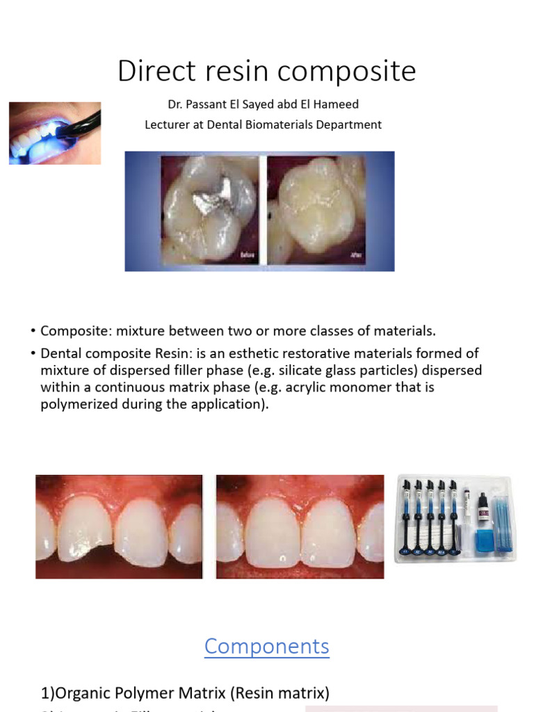 Overview of Dental Composite Resins | PDF | Dental Composite ...