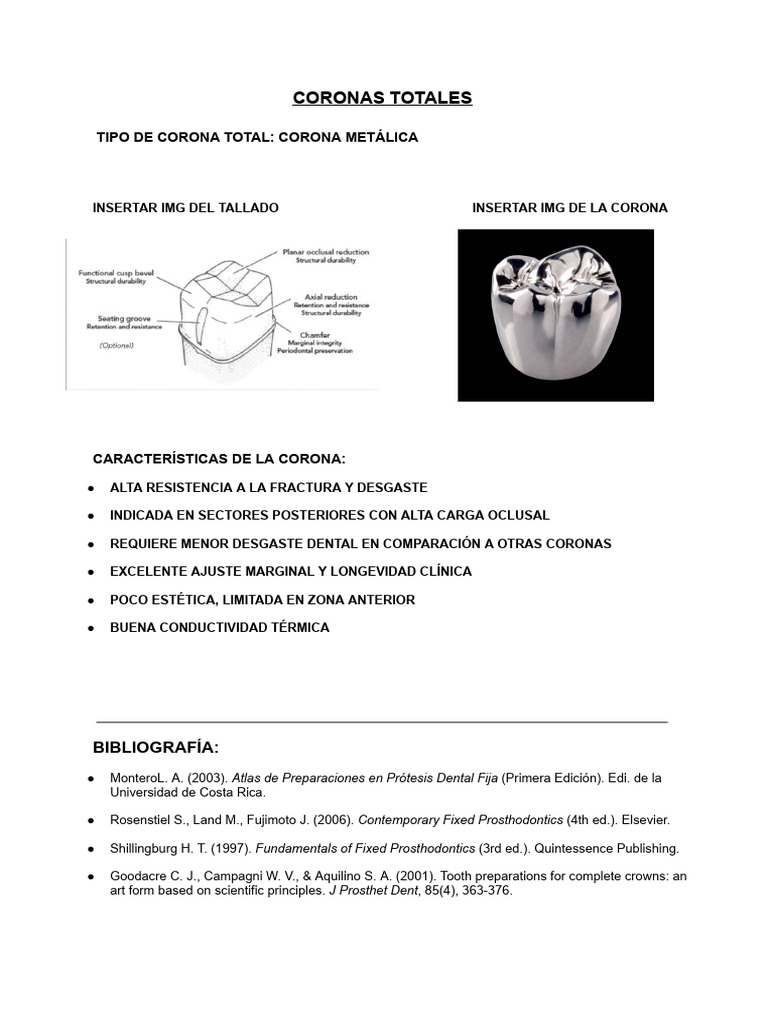 Corona Metálica y Ajuste Marginal | PDF