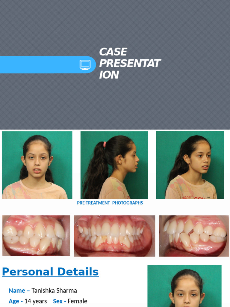 Orthodontic Case Study: Tanishka Sharma | PDF | Mouth | Tooth