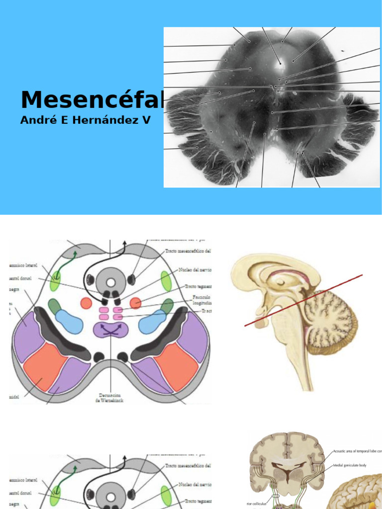 Mesencéfalo | PDF
