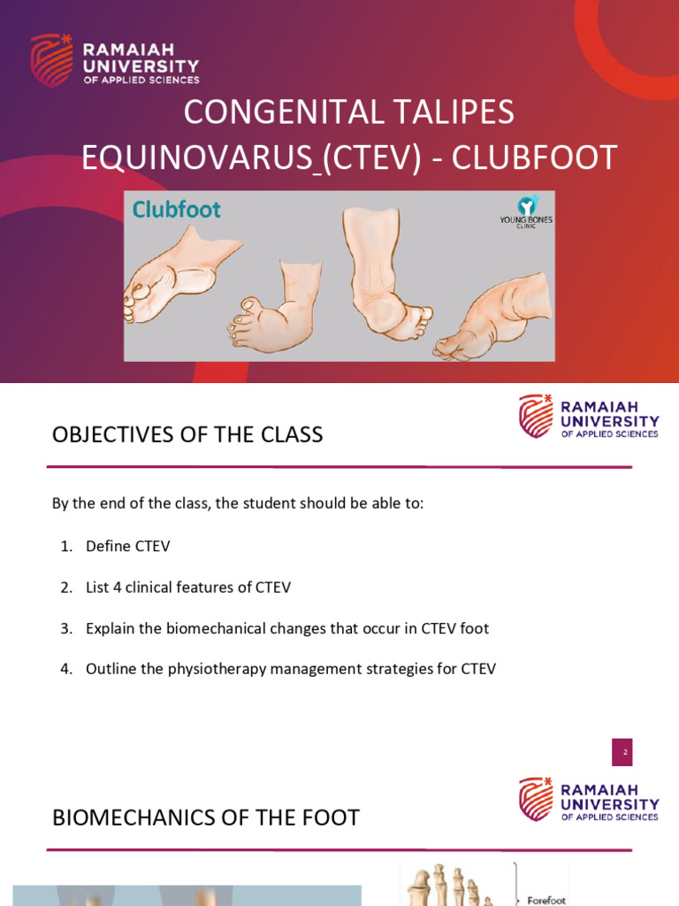 Understanding CTEV: Deformities and Management | PDF | Foot ...