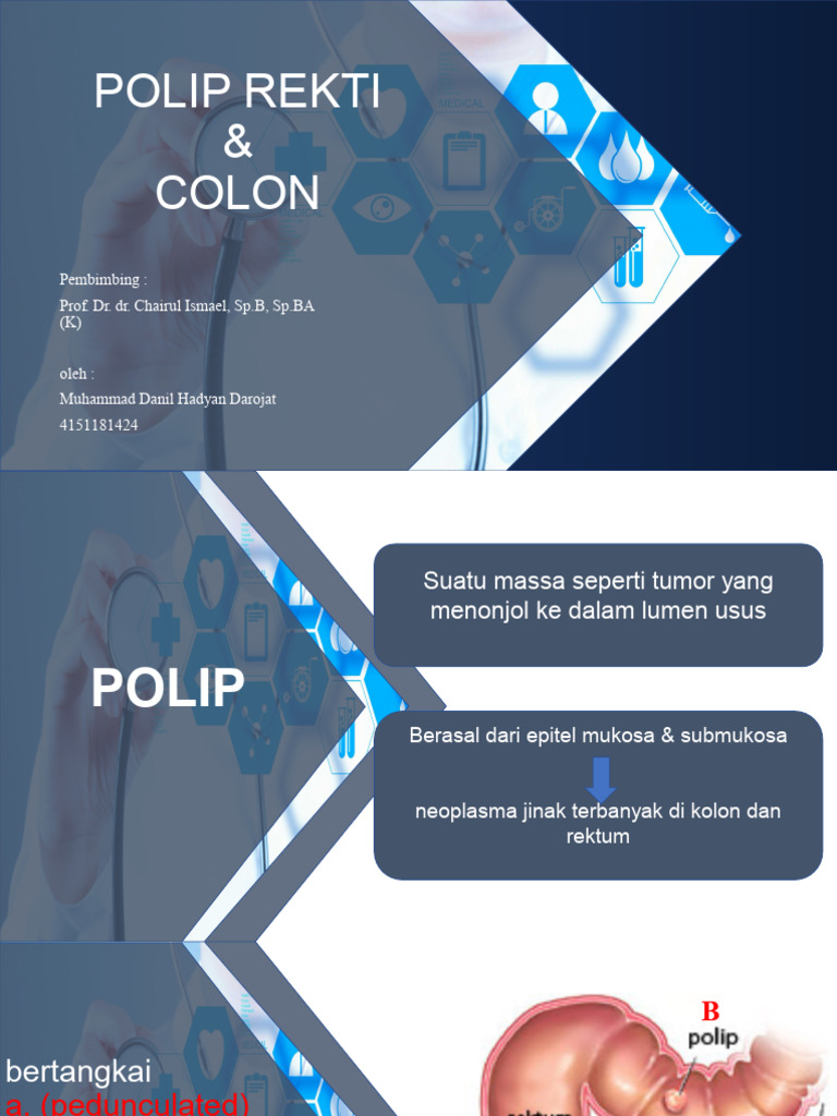 Panduan Lengkap Polip Rektum dan Kolon | PDF