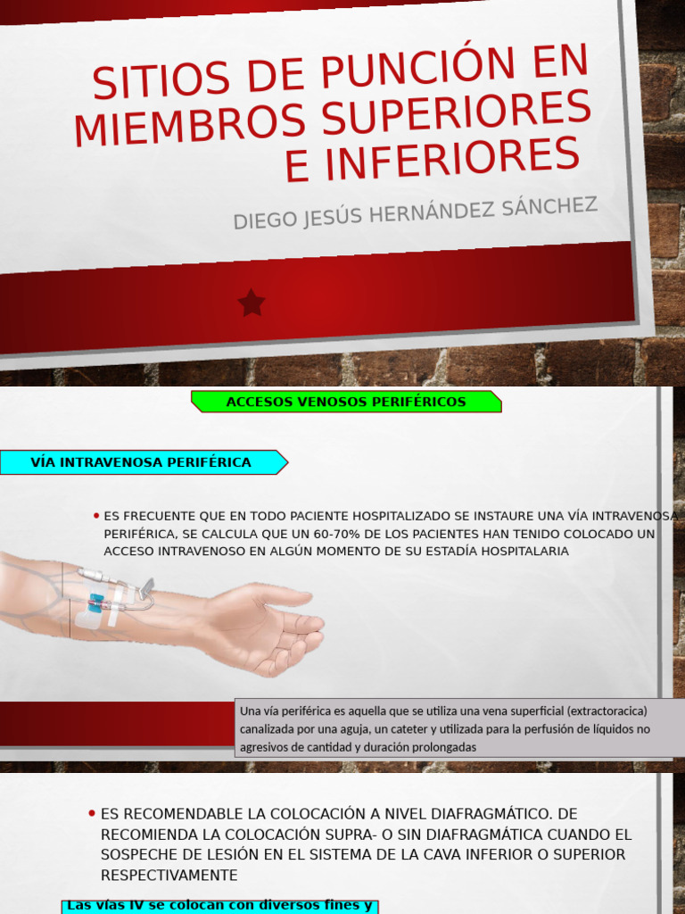 Sitios de Puncion | PDF | Terapia intravenosa | Embolia