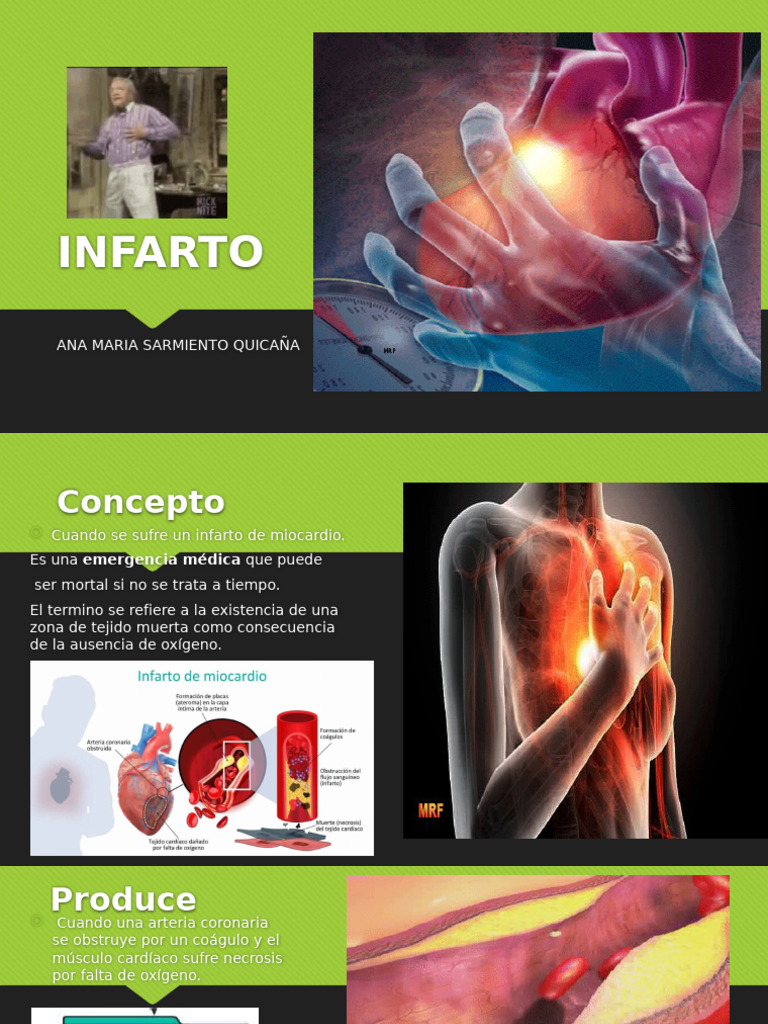 Infarto: Síntomas, Diagnóstico y Tratamiento | PDF | Infarto de ...