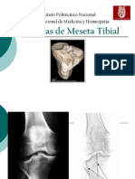 Fracturas de Meseta Tibial Expo 1221005581814517 9