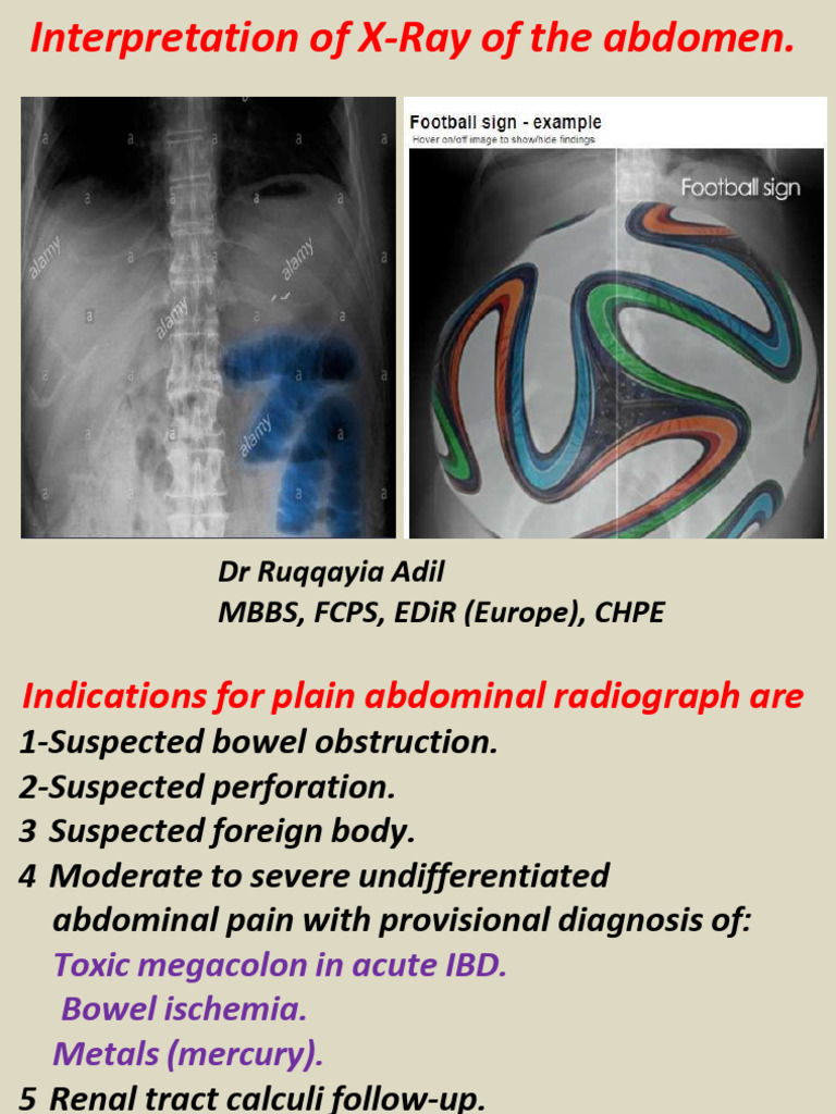 abdominal-x-ray-interpretation-guide-pdf-abdomen-peritoneum