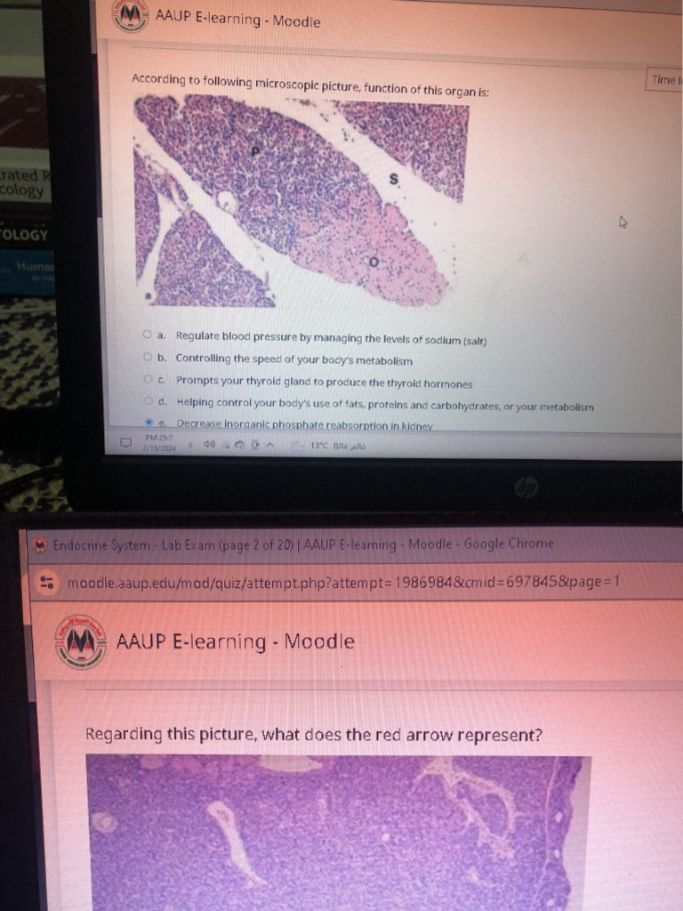 Endo Lab Final | PDF
