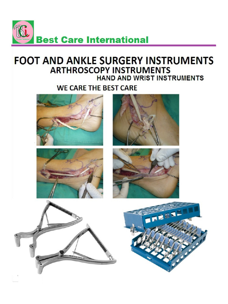Foot and Ankle Surgery Catalogue | PDF